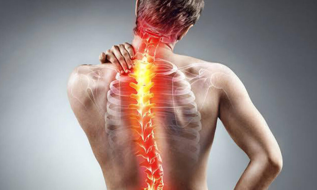 Lifestyle-Induced Spinal Problems and Progressive Disability