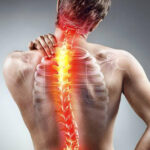 Lifestyle-Induced Spinal Problems and Progressive Disability